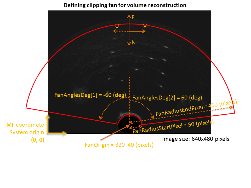 Curvilinear ROI