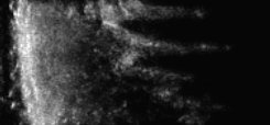 Spine ultrasound scan lines