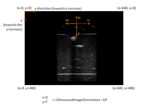 Ultrasound image orientation example