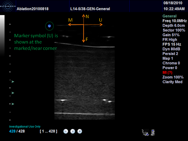 Ultrasound image orientation Ultrasonix software