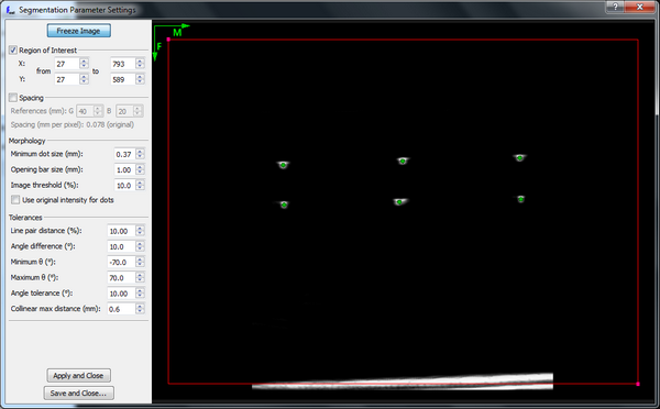 Ultrasound image orientations segmentation parameter window