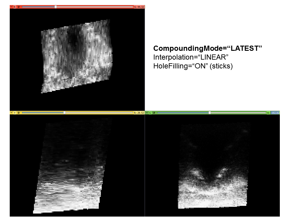 Volume reconstruction compounding latest