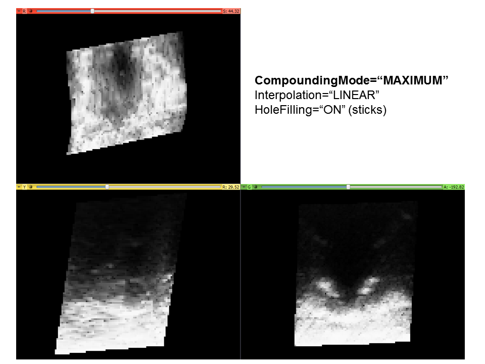 Volume reconstruction compounding max